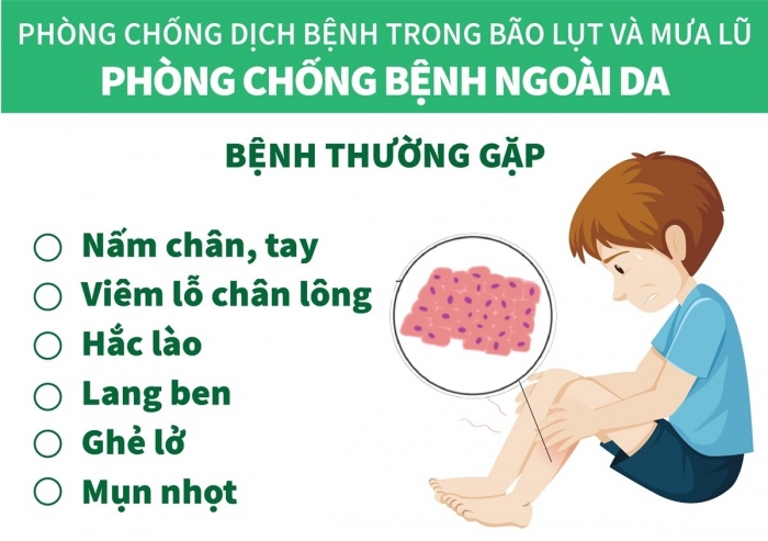 Phòng chống bệnh ngoài da trong mùa bão lụt và FV88 Com Link Đăng Nhập Trang Chủ Không Bị Chặn