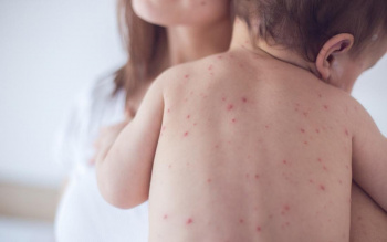Triển khai hiệu quả công tác tiêm chủng vắc xin phòng chống bệnh sởi